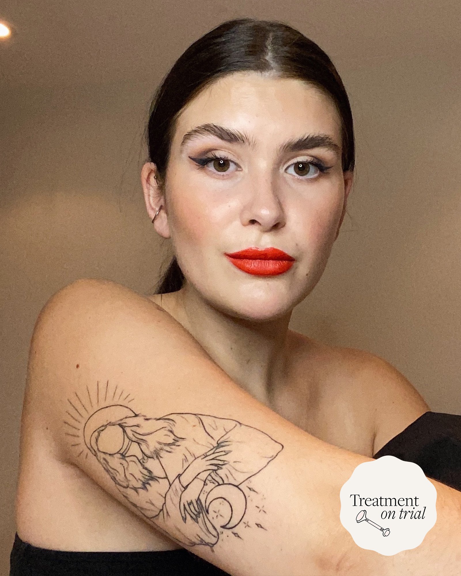 I Tried NAAMA's Laser Tattoo Removal, This Is What It Looks Like